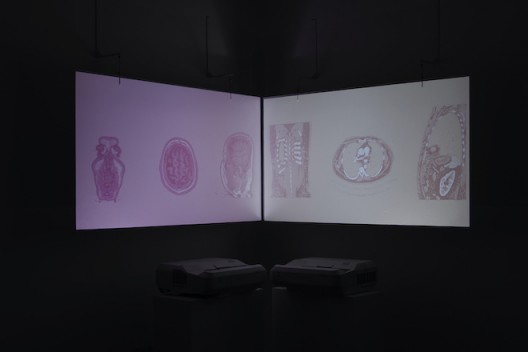 Zhang Peili, video, 2019. (Courtesy the artist and Rén Space)